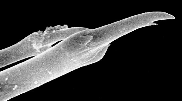 Scanning electron microscope (SEM) view of trifurcate chaetae in posterior segments.