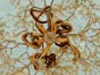 A close look at Metallogorgia with basket star.