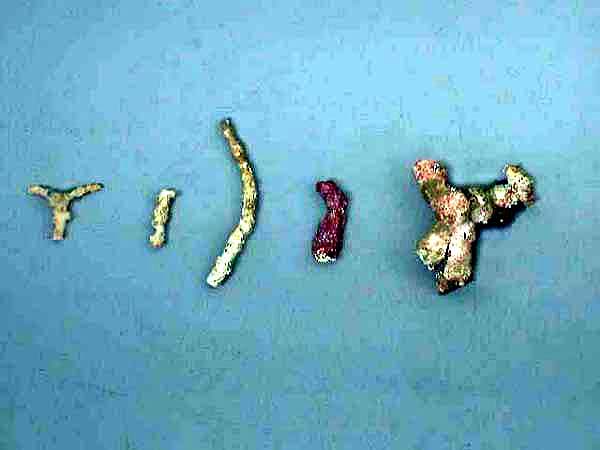 Stages of oculina decay